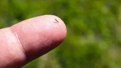  How to get rid of splinters without needles and pain