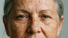 5 real causes of age spots you should know about (selection)